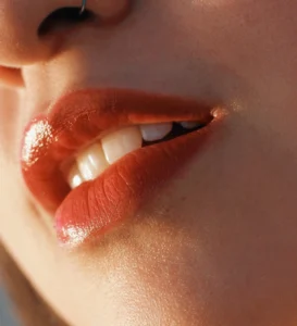 facial balancing with fillers